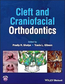 عکس Cleft and Craniofacial Orthodontics 1st Edition