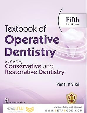 Textbook of Operative Dentistry
