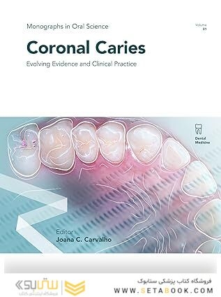Coronal Caries: Evolving Evidence and Clinical Practice (ISSN) 1st Edition