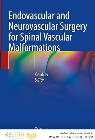 Endovascular and Neurovascular Surgery for Spinal Vascular Malformations