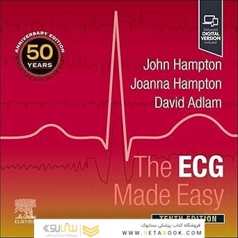 The ECG Made Easy