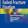 Failed Fracture Fixation: Revision Surgery Made Easy