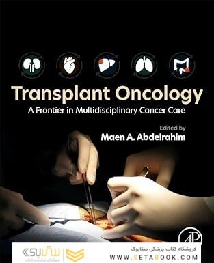 Transplant Oncology 1st Edition