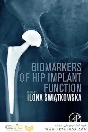 Biomarkers of Hip Implant Function: Diagnostic Modalities to Prevent Chronic Periprosthetic Joint Infection and Implant Failure 1st Edition