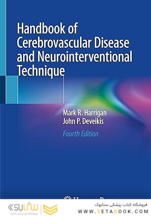 Handbook of Cerebrovascular Disease and Neurointerventional Technique