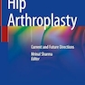 Hip Arthroplasty: Current and Future Directions 1st ed