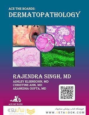 Ace The Boards: Dermatopathology