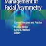 Management of Facial Asymmetry: Current Principles and Practice