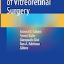 Practical Manual of Vitreoretinal Surgery