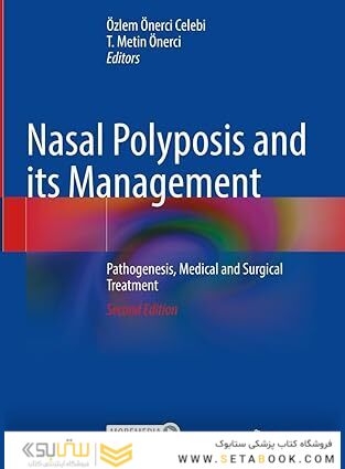 Nasal Polyposis and its Management: Pathogenesis, Medical and Surgical Treatment Second Edition