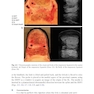 Ultrasound-Guided Procedures in Equine Orthopedics and Surgery