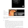 Ultrasound-Guided Procedures in Equine Orthopedics and Surgery