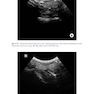 Ultrasound-Guided Procedures in Equine Orthopedics and Surgery
