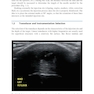 Ultrasound-Guided Procedures in Equine Orthopedics and Surgery