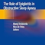 The Role of Epiglottis in Obstructive Sleep Apnea