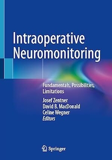 عکس Intraoperative Neuromonitoring: Fundamentals, Possibilities, Limitations