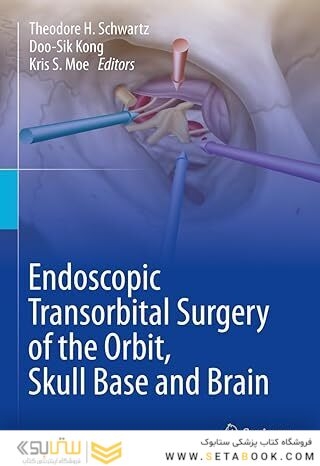 ndoscopic Transorbital Surgery of the Orbit, Skull Base and Brain