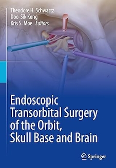 عکس ndoscopic Transorbital Surgery of the Orbit, Skull Base and Brain
