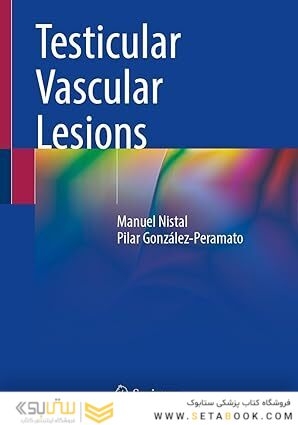 Testicular Vascular Lesions