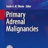 Primary Adrenal Malignancies