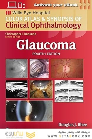 Glaucoma (Wills Eye Institute Atlas Series) Fourth Edition