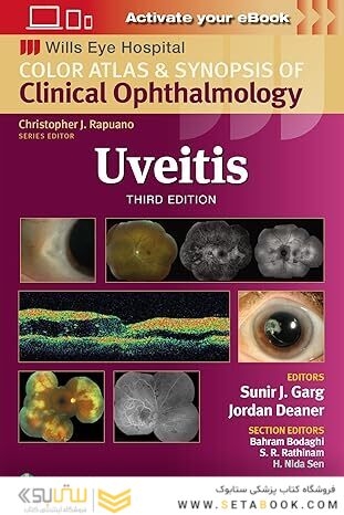 Uveitis (Wills Eye Institute Atlas Series) Third Edition