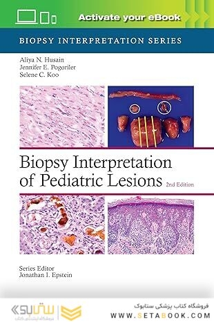Biopsy Interpretation of Pediatric Lesions:Second Edition