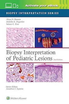 عکس Biopsy Interpretation of Pediatric Lesions:Second Edition