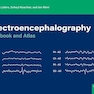 Electroencephalography: Textbook and Atlas