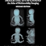 Fetal and Perinatal Skeletal Dysplasias: An Atlas of Multimodality Imaging 2nd Edition