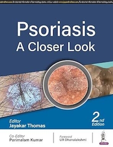 عکس Psoriasis: A Closer Look