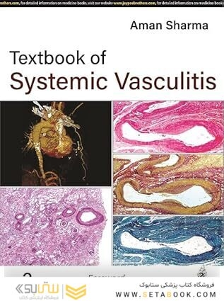 Textbook of Systemic Vasculitis 2nd Edition