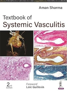عکس Textbook of Systemic Vasculitis 2nd Edition