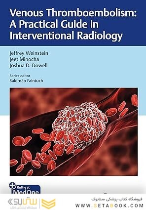 Venous Thromboembolism: A Practical Guide in Interventional Radiology
