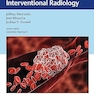Venous Thromboembolism: A Practical Guide in Interventional Radiology