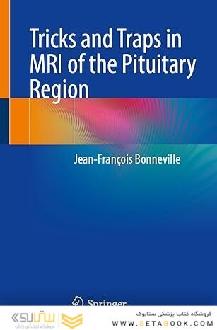 Tricks and Traps in MRI of the Pituitary Region