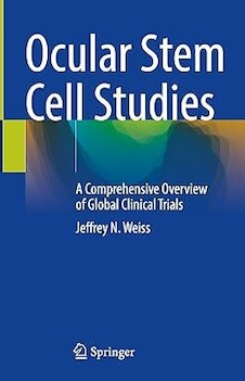 عکس Ocular Stem Cell Studies: A Comprehensive Overview of Global Clinical Trials