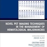Novel PET Imaging Techniques in the Management of Hematologic Malignancies, An Issue of PET Clinics