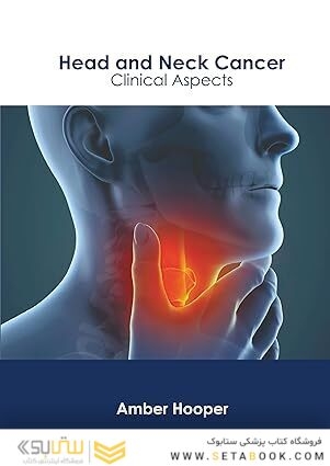 Head and Neck Cancer: Clinical Aspects