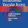Intraosseous Vascular Access: A Guide for Healthcare Professionals