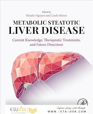 Metabolic Steatotic Liver Disease: Current Knowledge, Therapeutic Treatments, and Future Directions 1st Edition