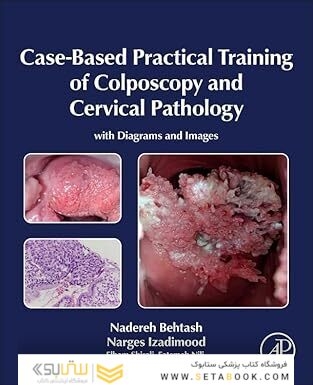 Case-Based Practical Training of Colposcopy and Cervical Pathology: With Diagrams and Images