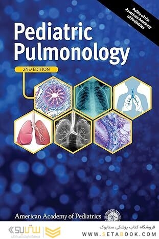 Pediatric Pulmonology 2nd Edition
