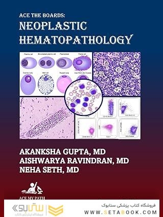 Ace The Boards: Neoplastic Hematopathology: Second Edition