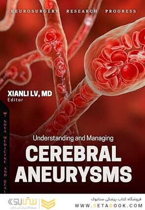 Understanding and Managing Cerebral Aneurysms