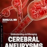 Understanding and Managing Cerebral Aneurysms