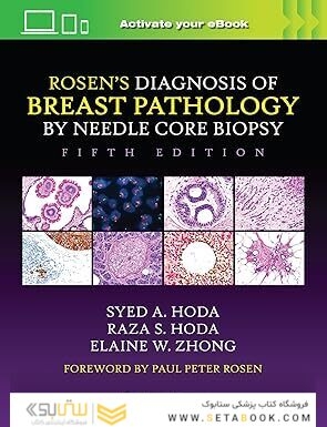 Rosen