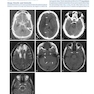 Fundamental Neuroscience for Basic and Clinical Applications 6th Edition