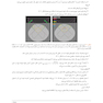طراحی درمان در رادیـوانکــولوژی