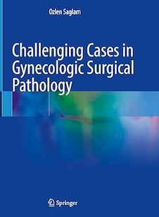 عکس Challenging Cases in Gynecologic Surgical Pathology